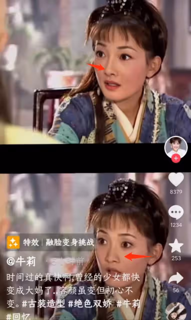 49歲牛莉又陷整容風波！山根高聳蘋果肌突出，超寬雙眼皮太搶鏡