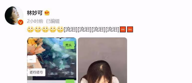 22歲童星林妙可曬禿頭照，頭頂頭髮少一大塊兒，在線發文求助網友