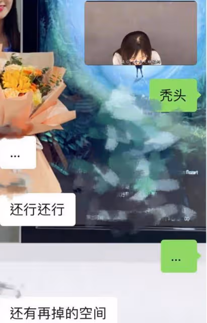 22歲童星林妙可曬禿頭照，頭頂頭髮少一大塊兒，在線發文求助網友