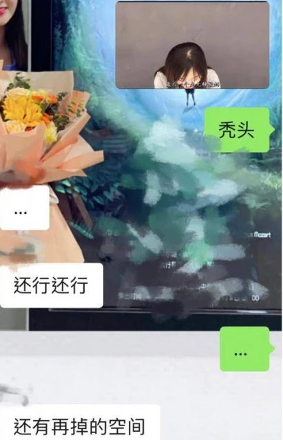 22歲童星林妙可曬禿頭照,頭頂頭髮少一大塊兒,在線發文求助網友