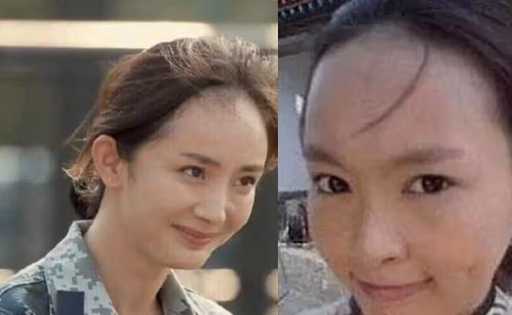 22歲童星林妙可曬禿頭照，頭頂頭髮少一大塊兒，在線發文求助網友