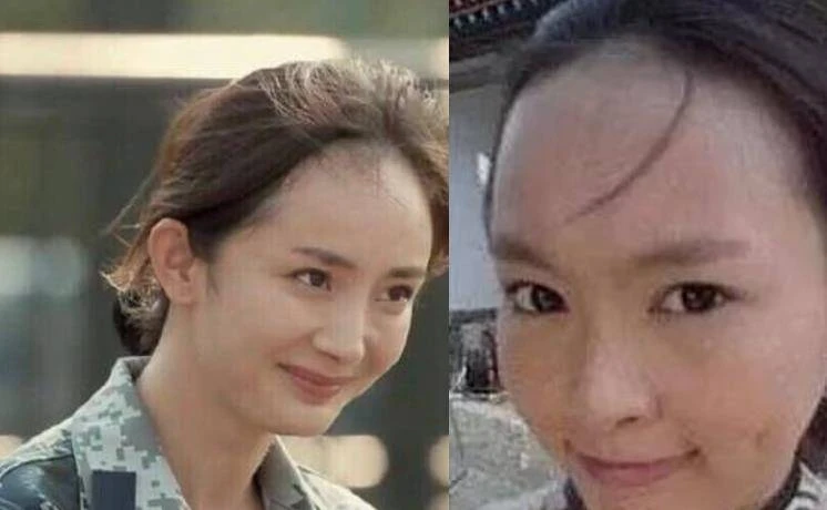 22歲童星林妙可曬禿頭照,頭頂頭髮少一大塊兒,在線發文求助網友
