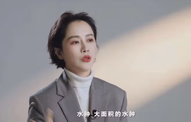 海清自曝韌帶撕裂長囊腫!曾痛到徹夜難眠,兒子抱她休息貼心照顧
