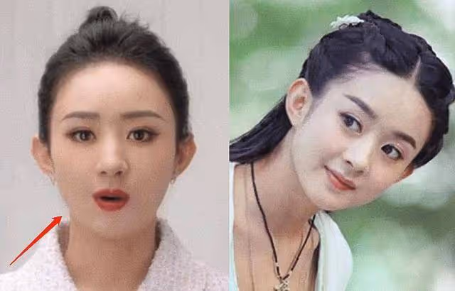 2023年女明星集體臉崩!劉詩詩大變樣,童謠被嘲小老太,楊紫老氣