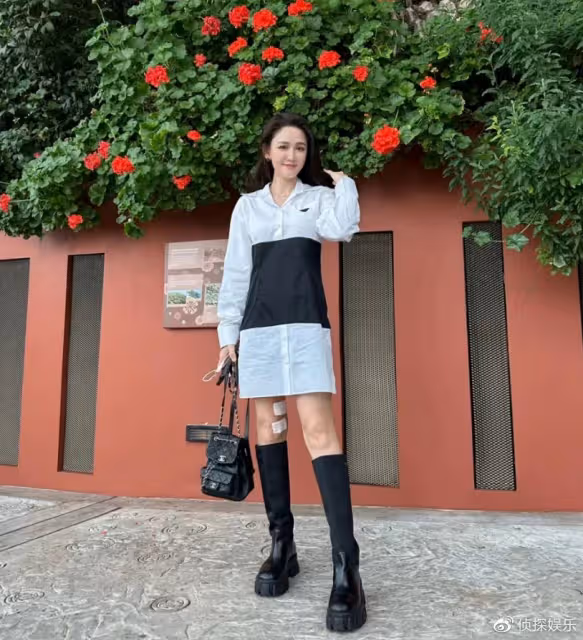 陳喬恩曬老公視角出遊照,打扮青春少女感足,腿部貼膠布引擔憂