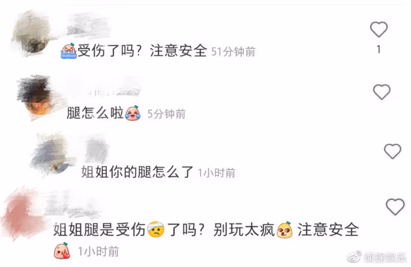 陳喬恩曬老公視角出遊照,打扮青春少女感足,腿部貼膠布引擔憂