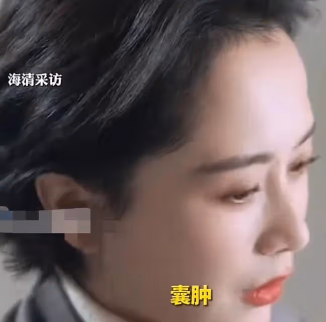 海清緊急回應!韌帶撕裂長囊腫屬實,沒退圈,過去一年和疾病鬥爭