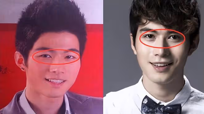 突發！陳學冬因車禍腿部受傷，多處打鋼釘無法行走，萬幸沒有毀容