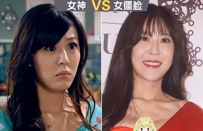 從整容臉崩,卻又奇蹟般恢復?從婁藝瀟到李金銘,都變得聰明了