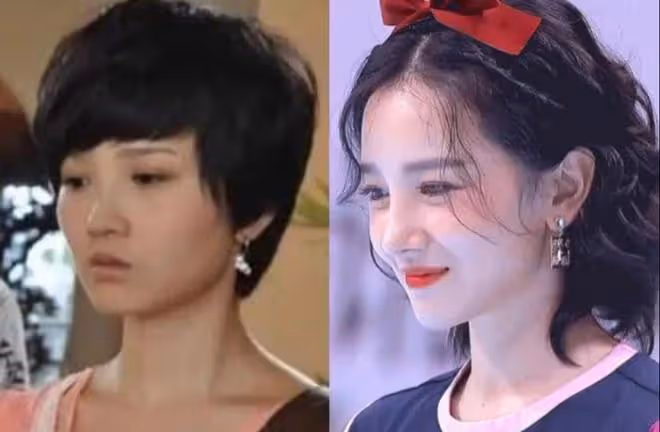 從整容臉崩,卻又奇蹟般恢復?從婁藝瀟到李金銘,都變得聰明了