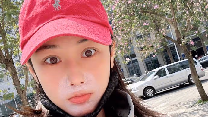 張馨予患脂溢性皮炎，臉上塗藥膏摘口罩後社死，網友打趣像熊大