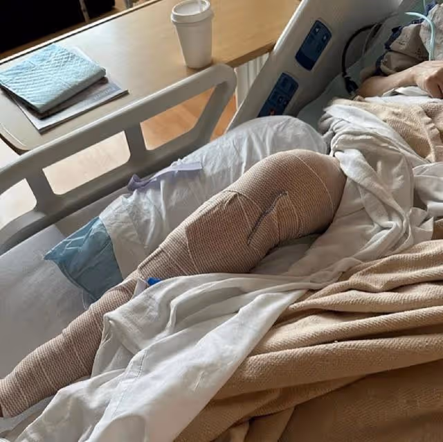 香港知名女星被曝與混血前任舊情復燃!滑雪摔斷腿,正住院治療