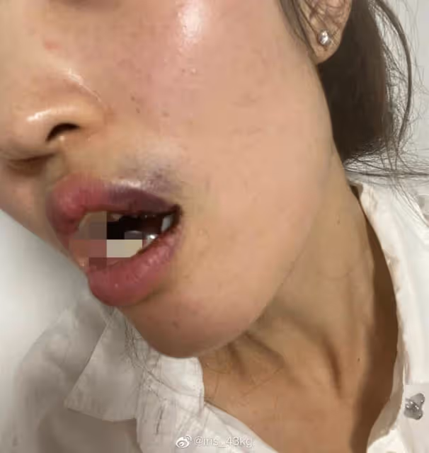 吳秀波長子被曝家暴,女生臉都被打歪,男方稱女人不聽話就要收拾