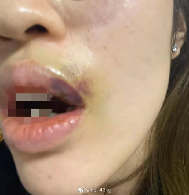 吳秀波長子被曝家暴,女生臉都被打歪,男方稱女人不聽話就要收拾