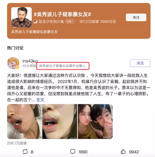 女子控訴吳秀波兒子,家暴多次並出軌,被打到無法吃飯患心理疾病