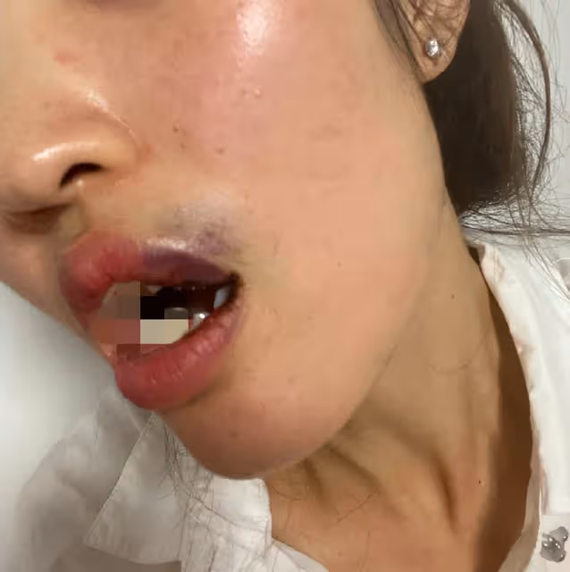 女子控訴吳秀波兒子,家暴多次並出軌,被打到無法吃飯患心理疾病