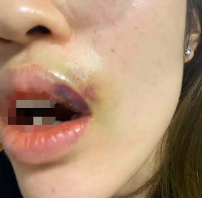 女子控訴吳秀波兒子,家暴多次並出軌,被打到無法吃飯患心理疾病
