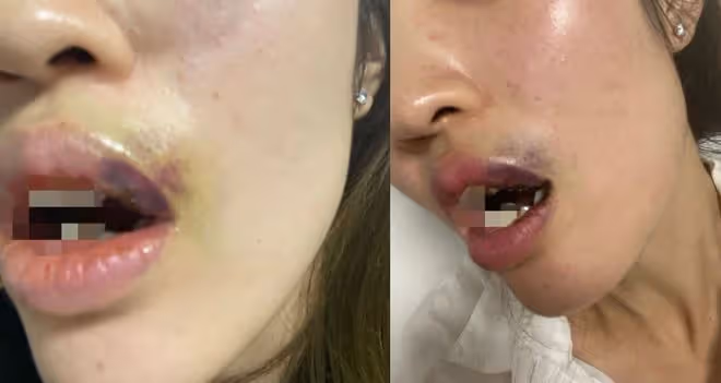 突發!吳秀波兒子把前女友打到滿嘴是血,女生控訴他家風不正