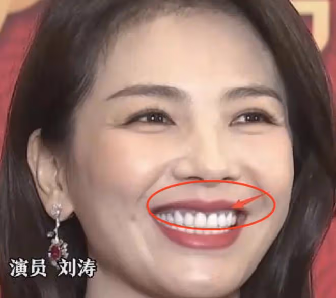 假髮假臀假肌肉,大半個娛樂圈「從頭假到腳」,還有真人嗎?