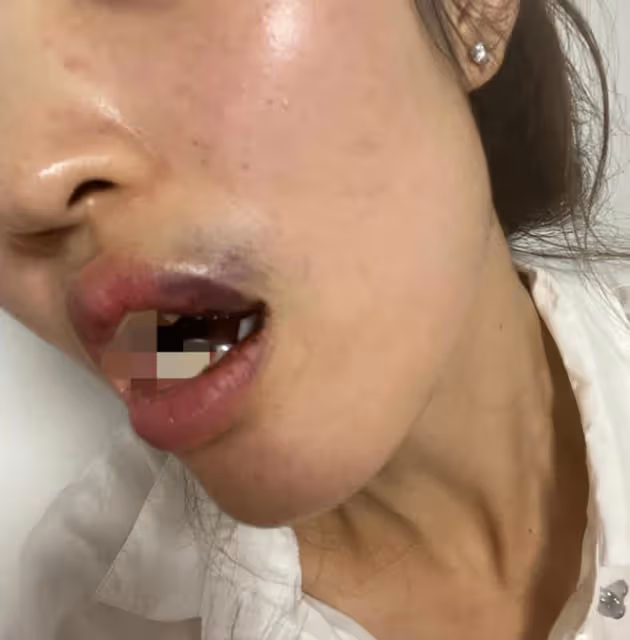 吳秀波兒子暴打前女友，女生滿嘴是血，控訴他出軌、家暴、撒謊