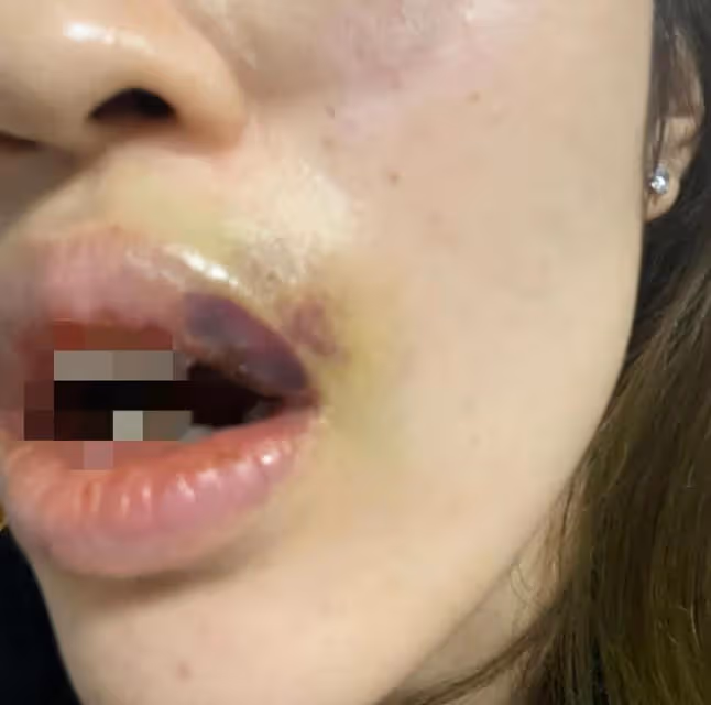 吳秀波兒子暴打前女友，女生滿嘴是血，控訴他出軌、家暴、撒謊
