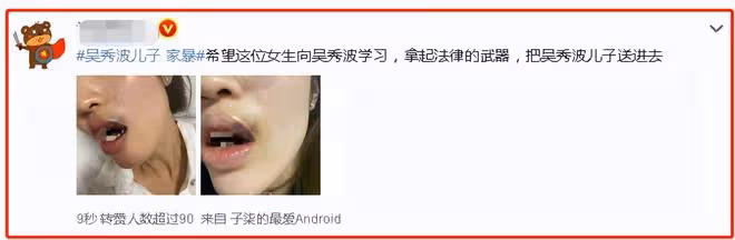 吳秀波兒子暴打前女友,女生滿嘴是血,控訴他出軌、家暴、撒謊