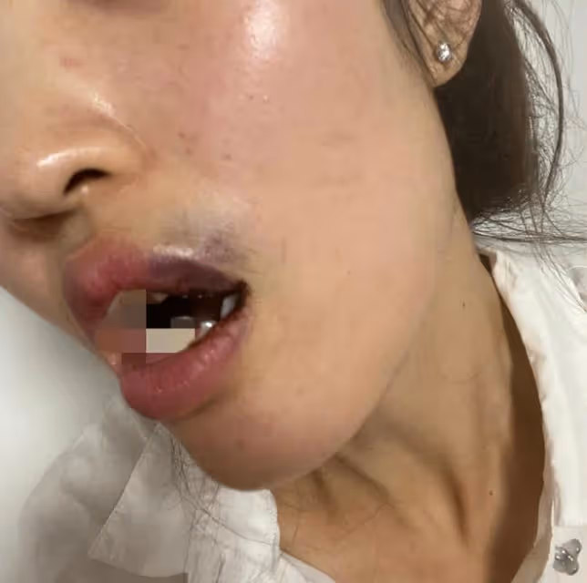 曝吳秀波長子出軌家暴!女方被打到嘴裡流血,分手後仍有心理問題