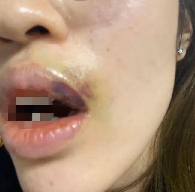 曝吳秀波長子出軌家暴！女方被打到嘴裡流血，分手後仍有心理問題