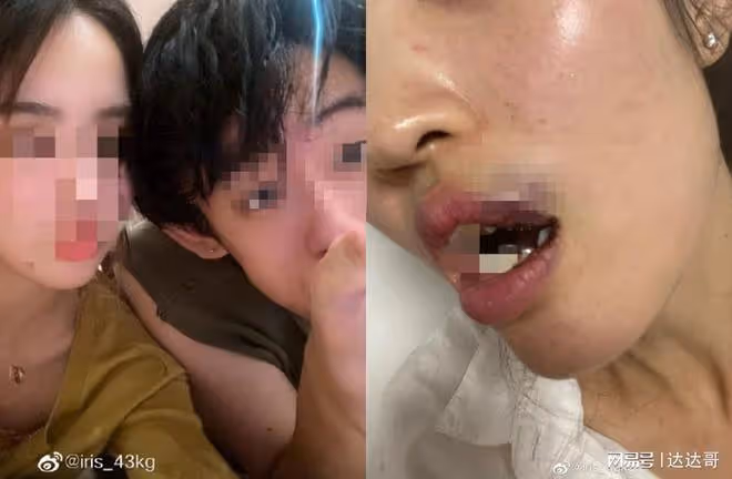吳秀波長子傳將女友打到嘴全是血 爽稱「跟我在一起是恩賜」