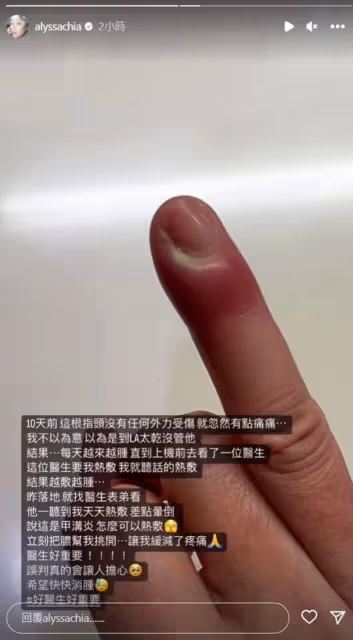 賈靜雯美國陪女兒意外受傷!手指化膿紅得發紫,被誤診忙返台求助