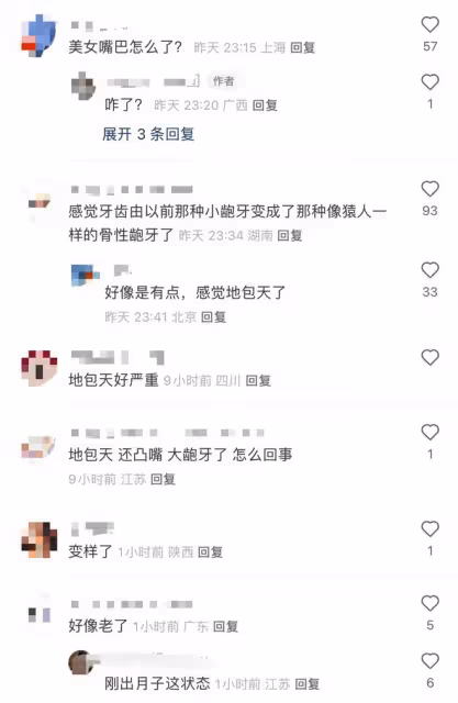 章澤天時裝周路透照大變樣!牙齒突出變地包天,眼袋下垂顯憔悴