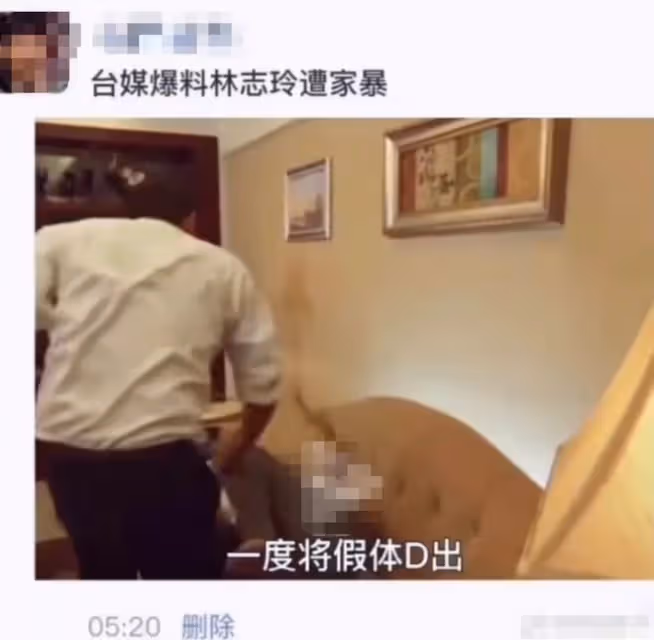 曝林志玲遭日本老公家暴！假體被打出回台灣修復，疑點多真假難辨