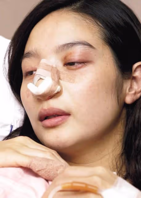曝林志玲遭日本老公家暴！假體被打出回台灣修復，疑點多真假難辨