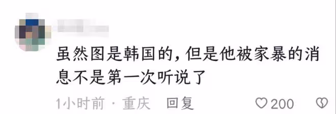 曝林志玲遭日本老公家暴！假體被打出回台灣修復，疑點多真假難辨
