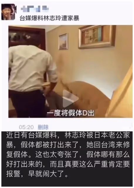 台媒曝林志玲遭老公家暴假體被打出，結婚3年多次被曝家暴好可憐