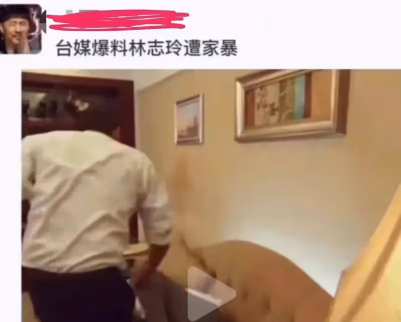 深夜瓜!網傳林志玲遭家暴照片,假體被打出,日籍老公多次出軌