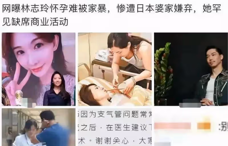 深夜瓜!網傳林志玲遭家暴照片,假體被打出,日籍老公多次出軌