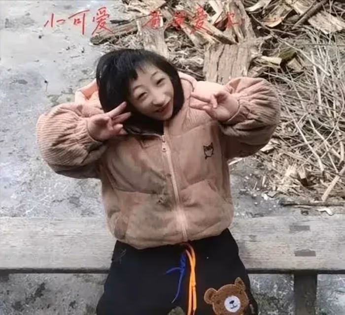 一產婦離奇生下一「小猴子」,雜技團得知,出25萬「高價收購」,14年後的今天,她怎麼樣了?