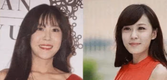 整容失敗的五位女藝人，第一個是「反面教材」，最後一個是太可惜