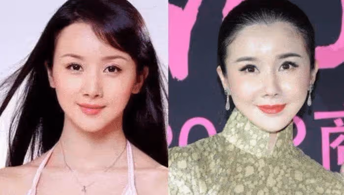 整容失敗的五位女藝人，第一個是「反面教材」，最後一個是太可惜