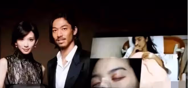 網傳林志玲遭家暴引熱議，台媒曝真相，受傷照另有其人