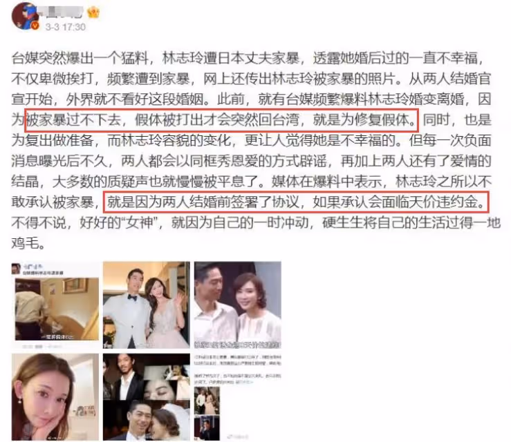 網傳林志玲遭家暴「打斷鼻骨」，黑澤良平：婚後互相尊重理性溝通