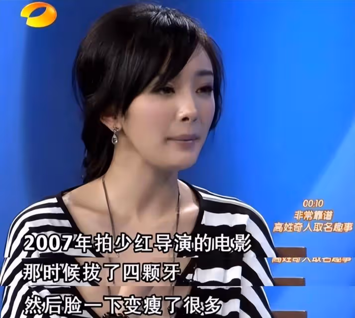 劉雯被質疑瘦過頭本人霸氣回應剛拔智齒，網友的反應太真實了