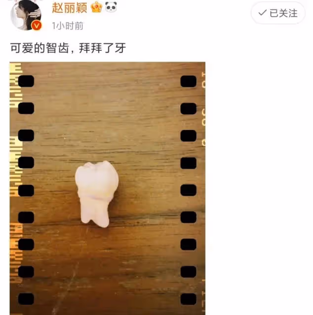 劉雯被質疑瘦過頭本人霸氣回應剛拔智齒，網友的反應太真實了