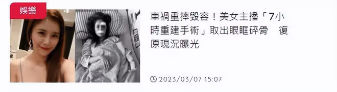 36歲女星騎單車摔傷毀容,歷時7小時手術,術後家人擔心引發癲癇