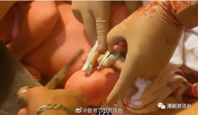 鍾嘉欣家中浴缸分娩過程曝光!向准媽媽派定心丸減輕恐懼