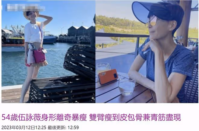 54歲伍詠薇健康引擔憂！身材消瘦青筋凸起，腳一度腫到像發麵饅頭