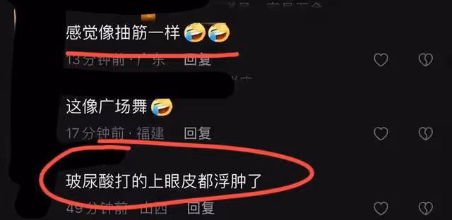 3位男星被質疑醫美過度:呂良偉古天樂吳剛,雙眼皮浮誇皺紋搶鏡