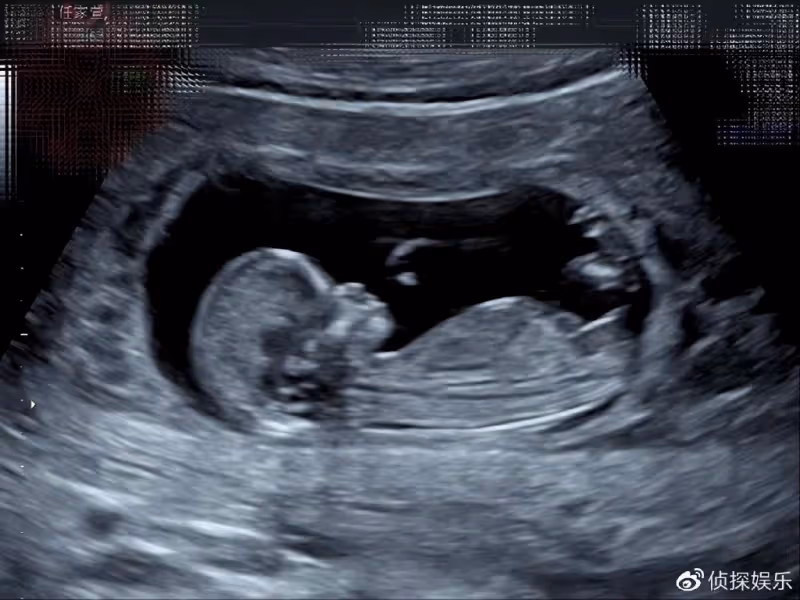 41歲任家萱官宣懷孕,曬寶寶B超照滿心喜悅,與小男友無結婚計劃