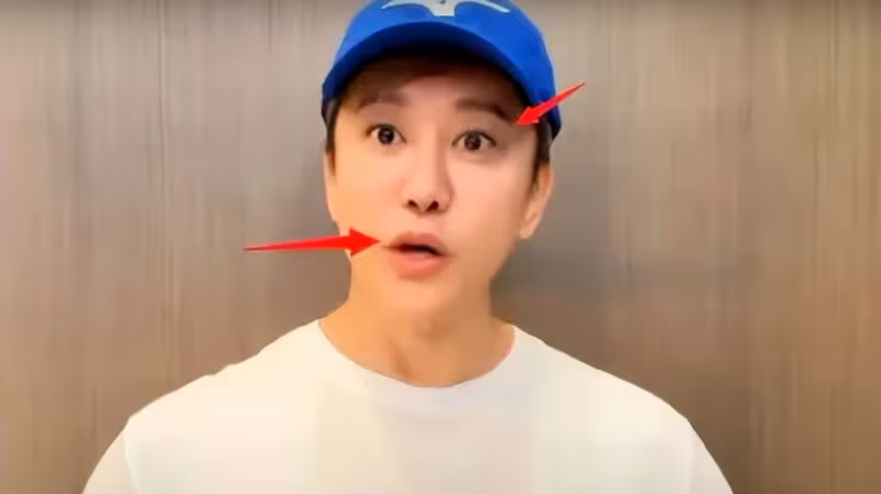 毛寧整容後氣質大變，帥大叔變精神小伙托尼，臉僵嘴歪但確實年輕